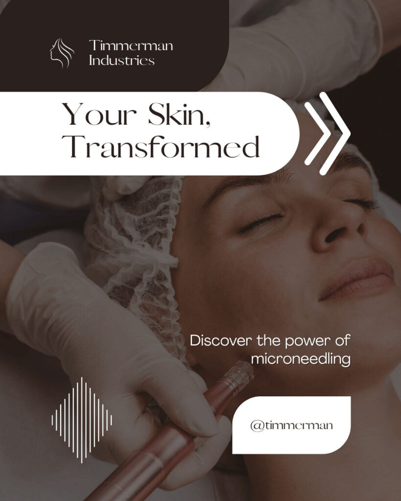 A person receives a microneedling facial treatment. Text reads: "Your Skin, Transformed. Discover the power of microneedling with our Ecommerce solutions. Timmerman Industries.